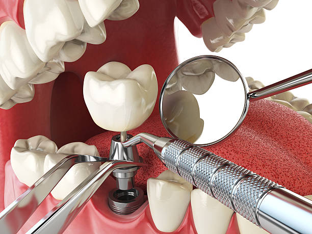 Best Broken or Chipped Tooth Repair in West Miami, FL
